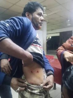 নোয়াখালীতে মোটরসাইকেলে এসে প্রকাশ্যে কৃষককে গুলি